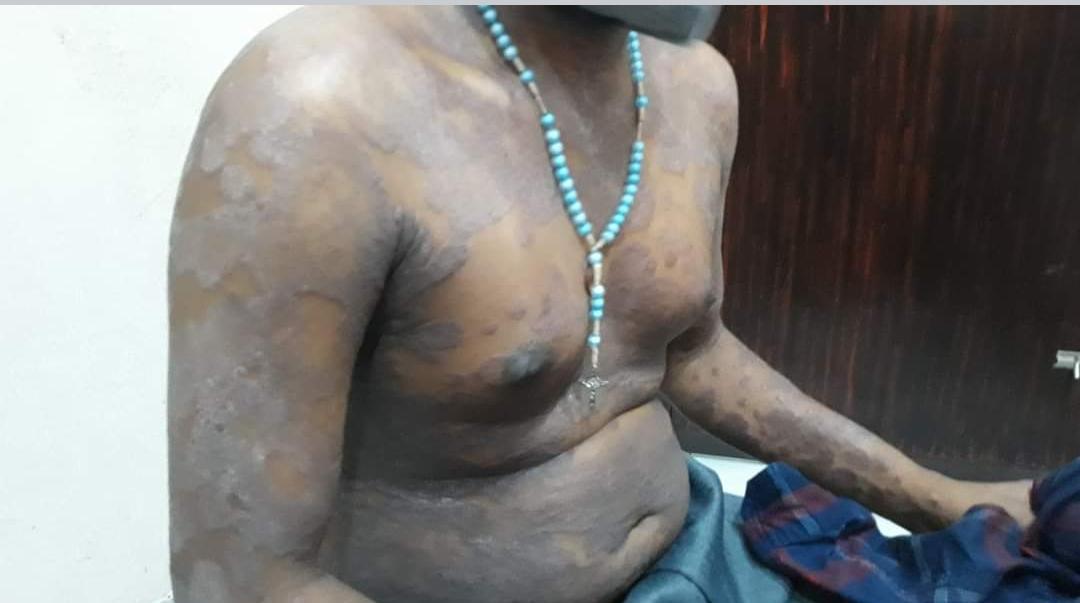 SIMILIA HOMOEO CLINIC IRITTY