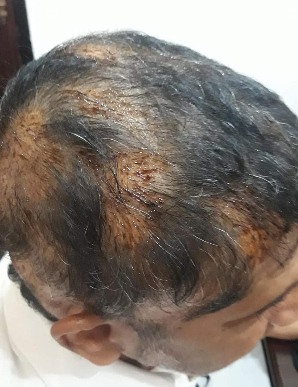 SIMILIA HOMOEO CLINIC IRITTY