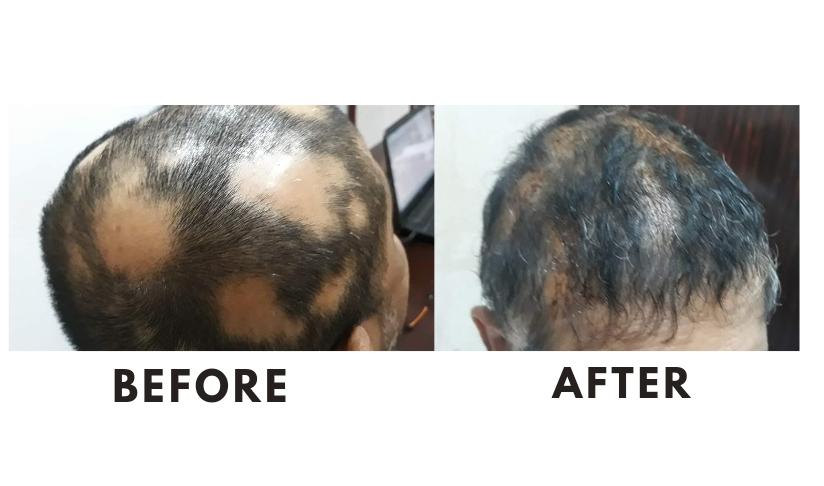 SIMILIA HOMOEO CLINIC IRITTY